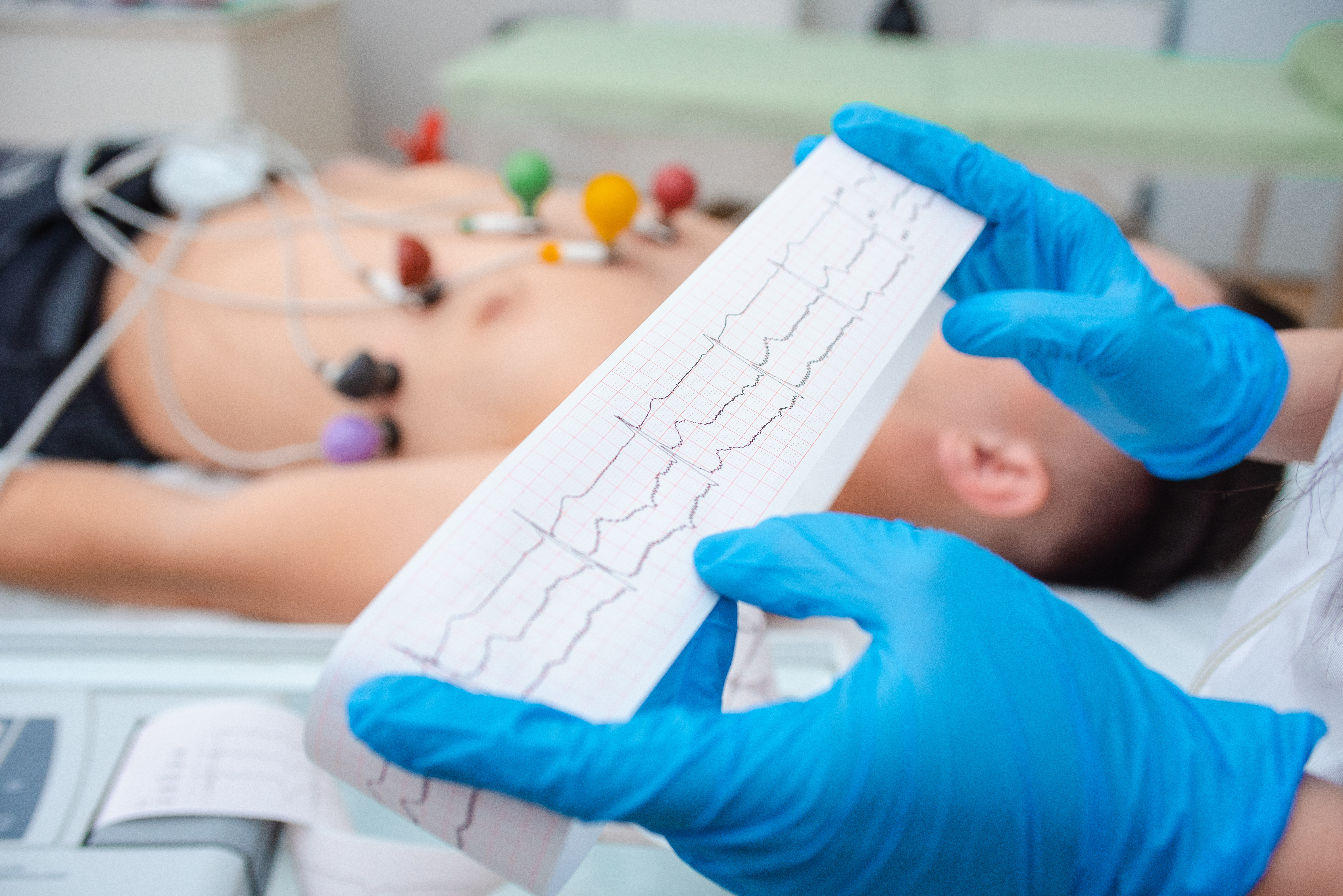 Doctor reviewing patient EEG tape